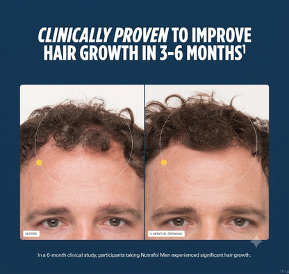 Nutrafol Men’s Hair Growth Supplement   (1 Month Supply)
