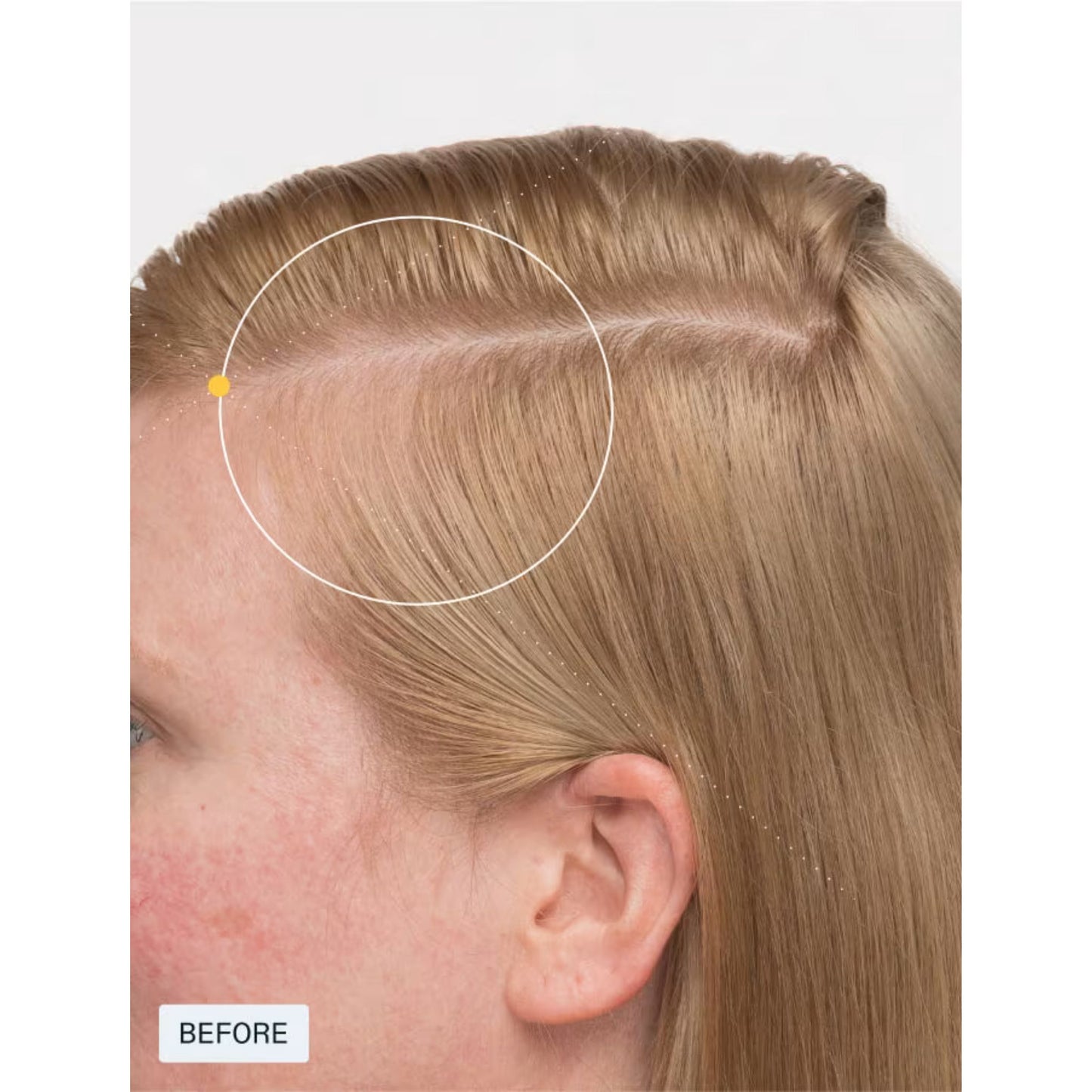 Nutrafol Women's Balance Hair Growth Supplement