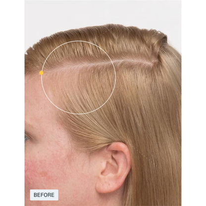 Nutrafol Women's Balance Hair Growth Supplement