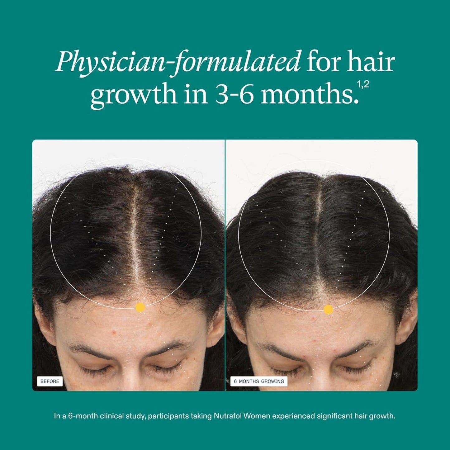 Nutrafol Women's Vegan Hair Growth - 120 Capsules